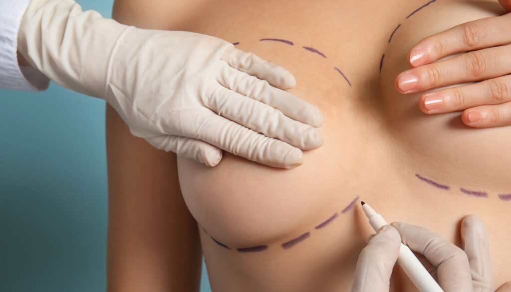 cat dureaza operatia de implant mamar