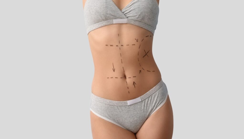 lipoaspiratie cluj