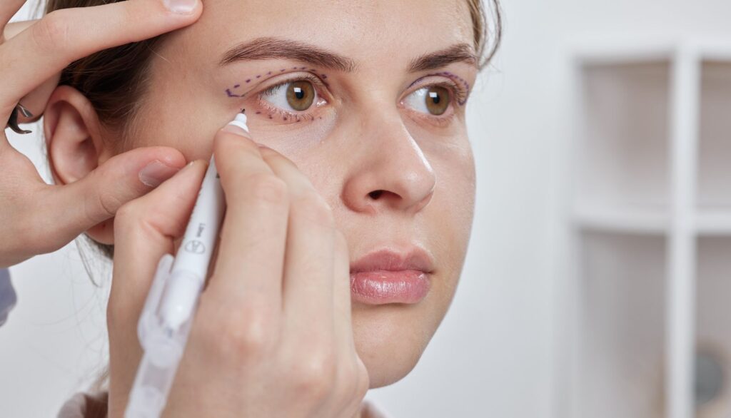 recuperare dupa o blefaroplastie