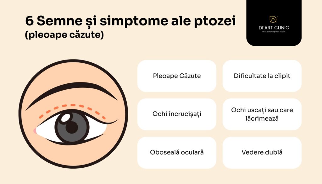 6 SEMNE Ale ptozei Palpebrale