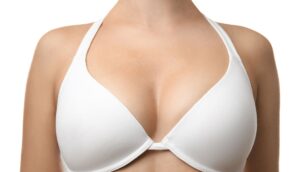 bustiera dupa implant mamar