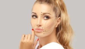 lifting facial chirurgical