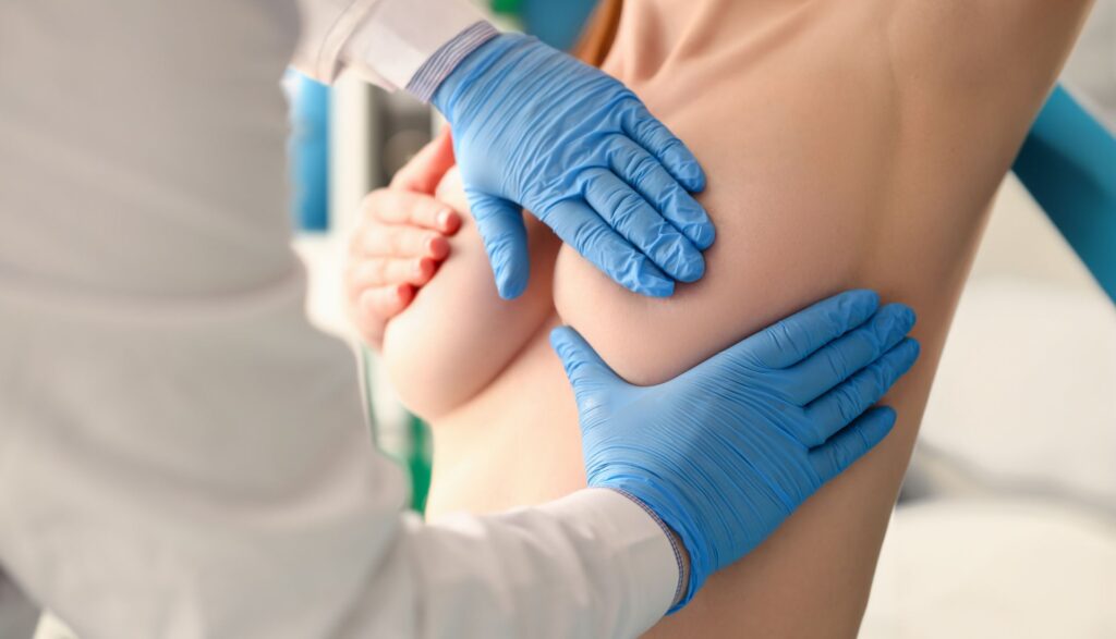 reductie mamara fara implant