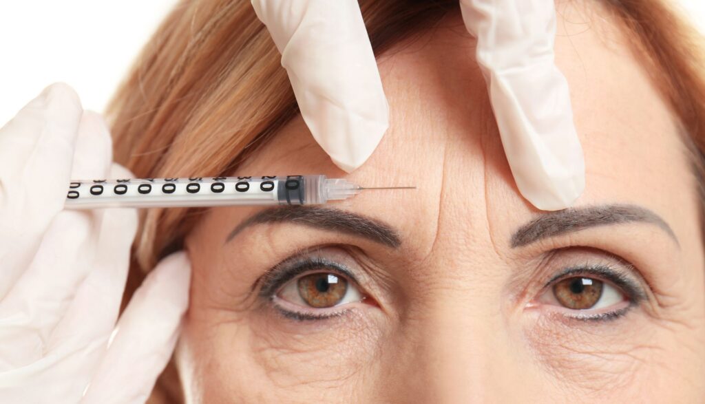 botox frunte