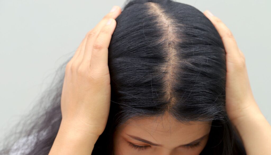 prp pentru caderea parului