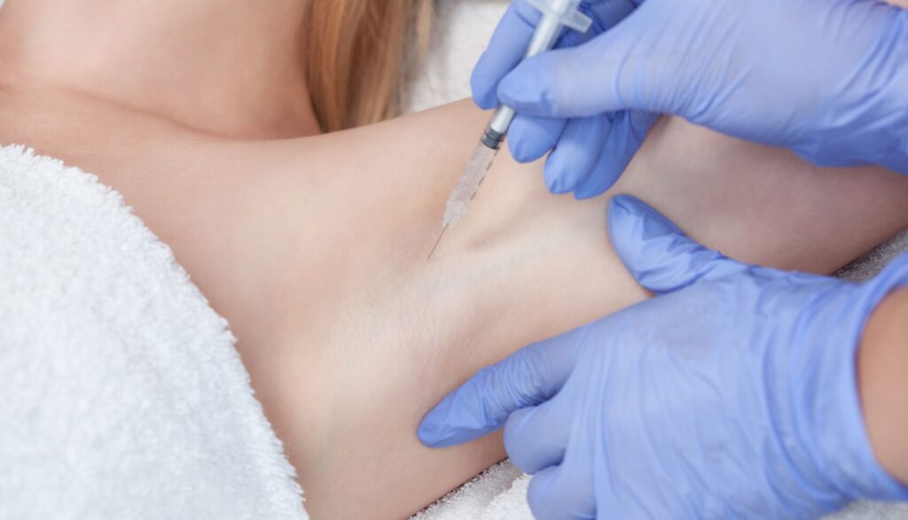 hiperhidroza transpiratie excesiva