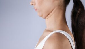 Lipoliza injectabilă pentru gușă